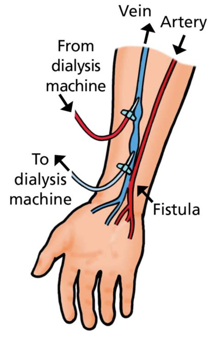 Do dialysis techs draw blood?