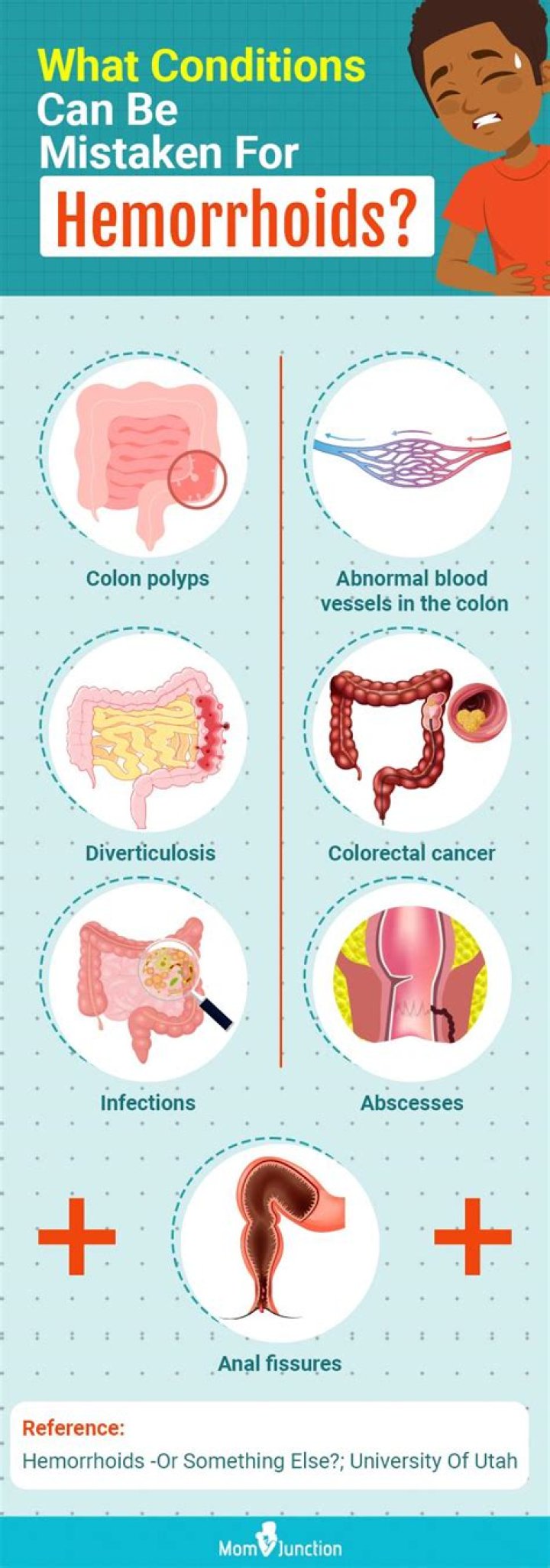 What do you put on hemorrhoids?