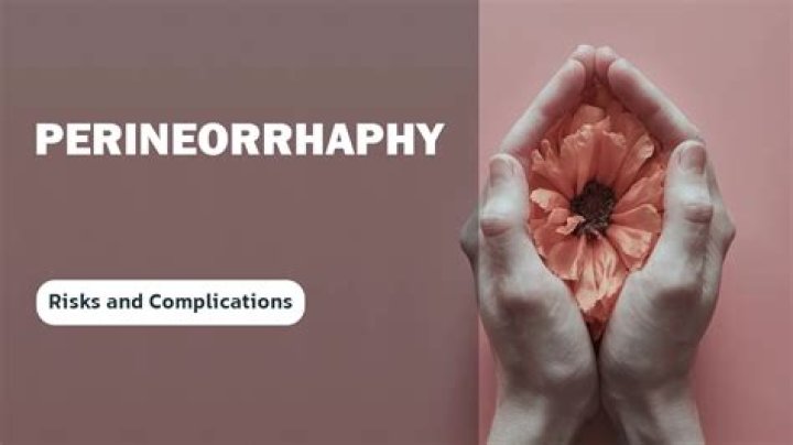 What does Perineorrhaphy mean? | ContextResponse.com