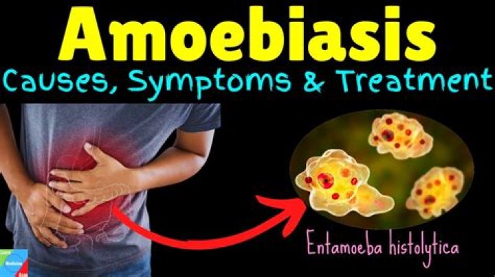 What should I eat if I have Amoebiasis?
